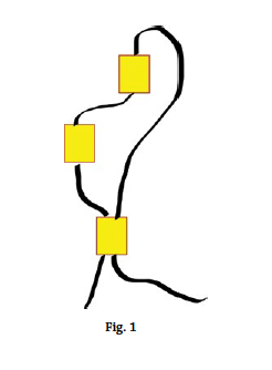 Les bases du point de Birck, figure 1